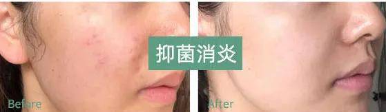 方法“颜霸”韩艺瑟，40岁肌肤细嫩透亮跟20岁没区别，方法是皮肤排浊