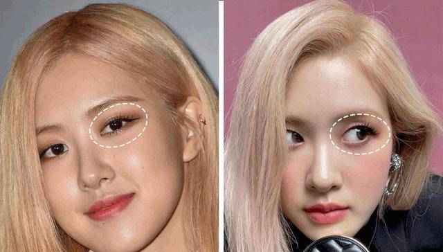 眼睛别再割双眼皮了!内双、肿眼泡的来啦!