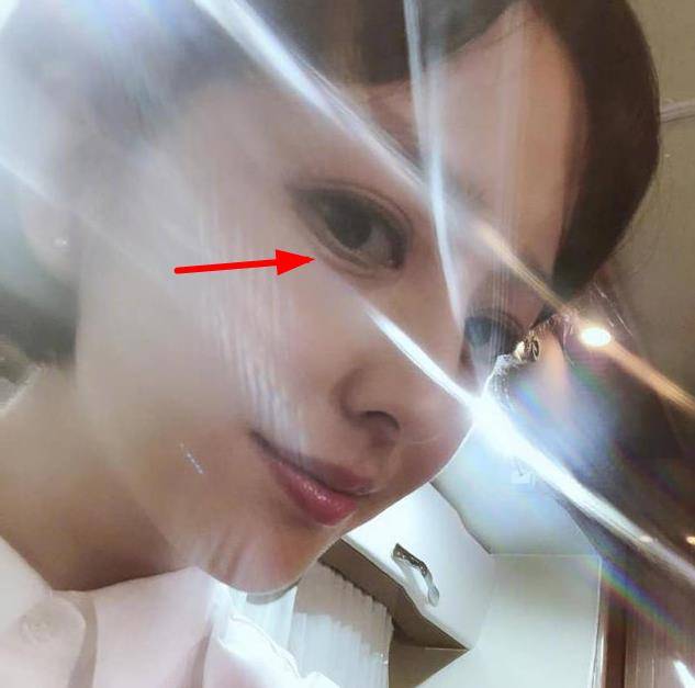 戚薇36岁佟丽娅老成这样?黑眼袋严重吓坏众人,粉丝:丫丫擦下眼霜吧