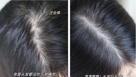 女神洗发水不是越贵越好！盘点5款38女神节孕妈必囤的洗发水，快收藏