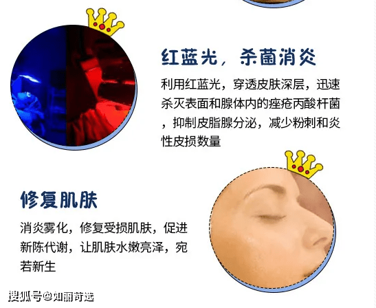 治疗痘痘只能靠医美手段改善吗？