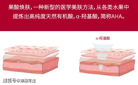 治疗痘痘只能靠医美手段改善吗？