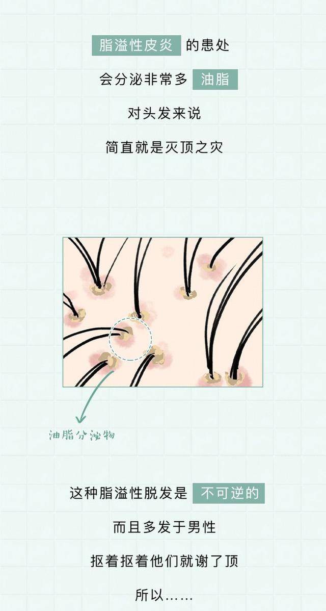 什么头皮出现“白色颗粒”，忍不住用手去挠？但你想过后果吗？