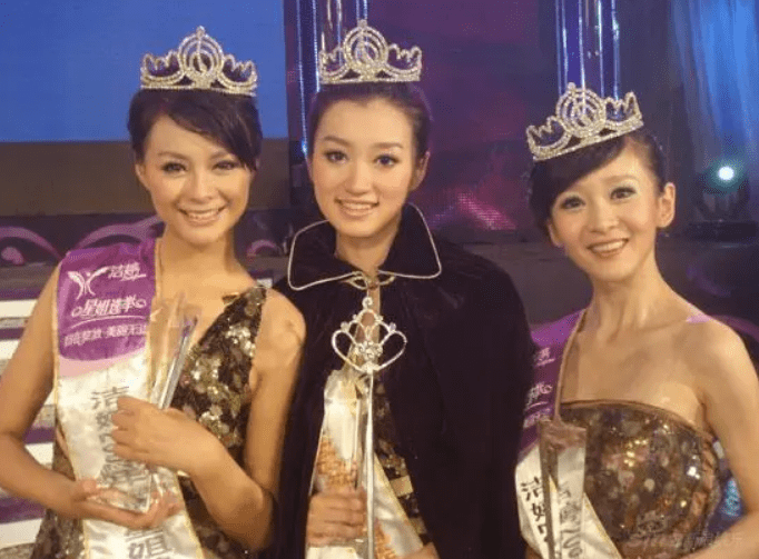 因为|为事业焦虑到斑秃的沈梦辰，被低估的沈梦辰！