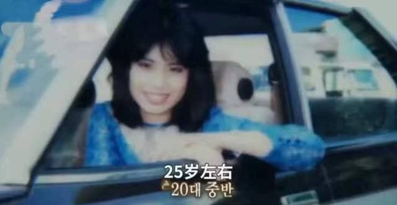 因为女星韩慧景：为了更漂亮，给脸注射食用油，把脸整成“猪头”