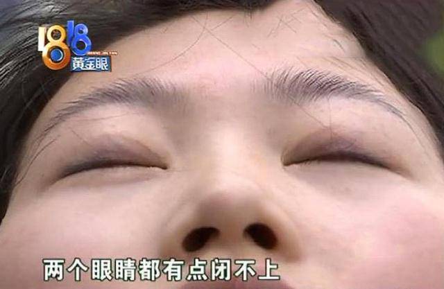 要求女子花3万整眼睛，做完手术后怒曝光：我晚上睡觉眼睛都闭不上！