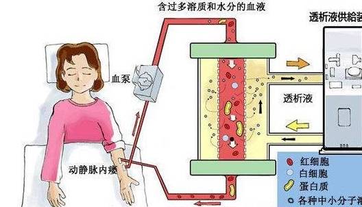 肾脏|肌酐升高，肾脏难以为继！挽救肾功能，医生支4招降肌酐