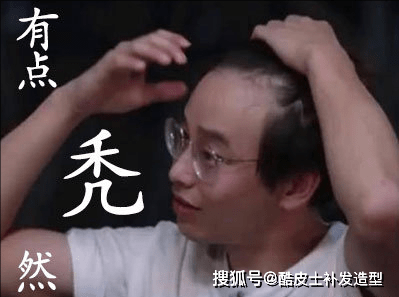 观点评论明星为了发际线有多拼？植发假发外加发际线粉，却败给胎毛王白鹿