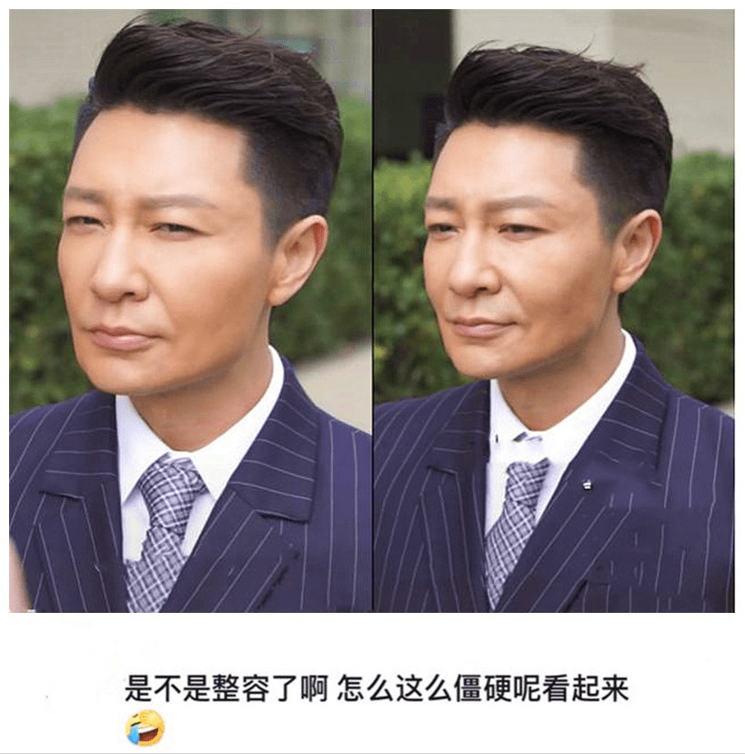 陈晓东脸部肿胀、五官扭曲，这些痴迷医美的男明星，不怕后遗症吗？？
