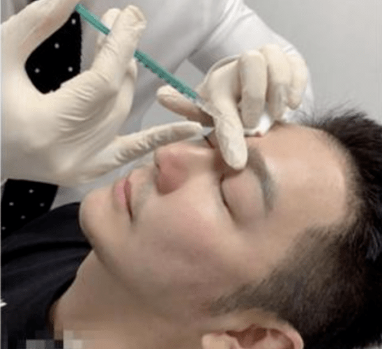 陈晓东脸部肿胀、五官扭曲，这些痴迷医美的男明星，不怕后遗症吗？？