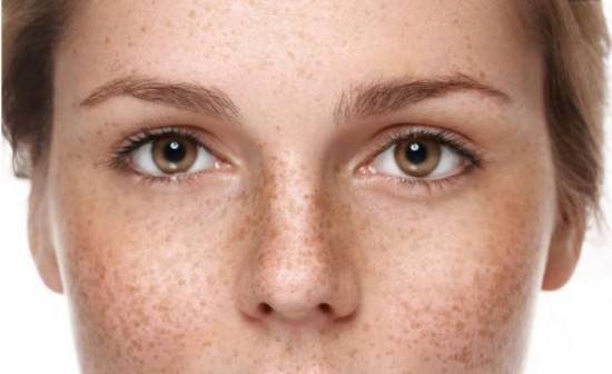 美容刷酸美容还能淡斑?“烂脸”警告!