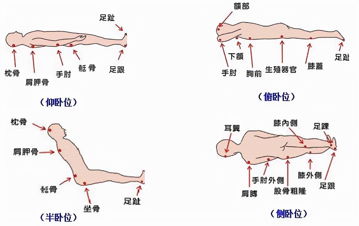 手術體位:仰臥位,側臥位,俯臥位,側俯臥位,斜仰聯合截石位等手術體位