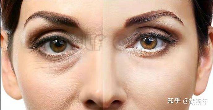 mm7d聚拉提做一次有效果吗、7d聚拉提做脸大概多久有效果、看懂了!