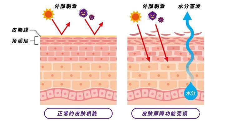 氧化春季如何保湿盈润？