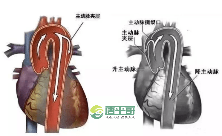 血管|糖尿病这几个危害影响全身，千万不能忽视