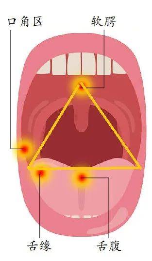 发病位置固定,常位于口腔内的"危险三角区,即舌缘舌腹,口角区内侧