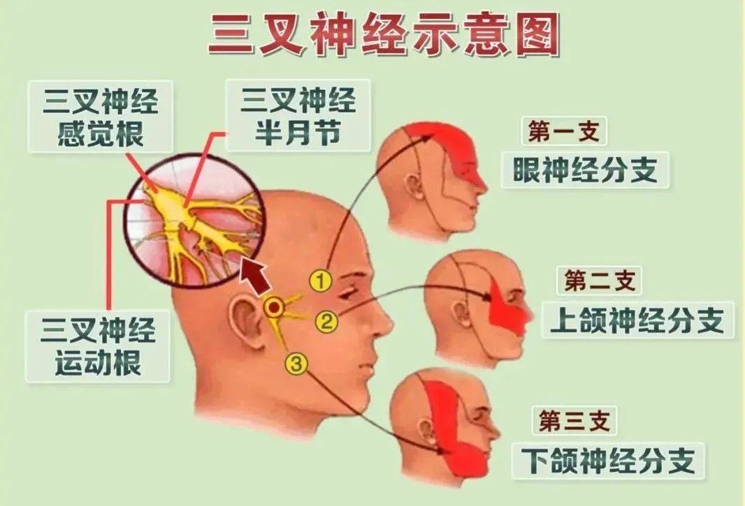 一招止痛数百人比生娃还疼的三叉神经痛感受一下