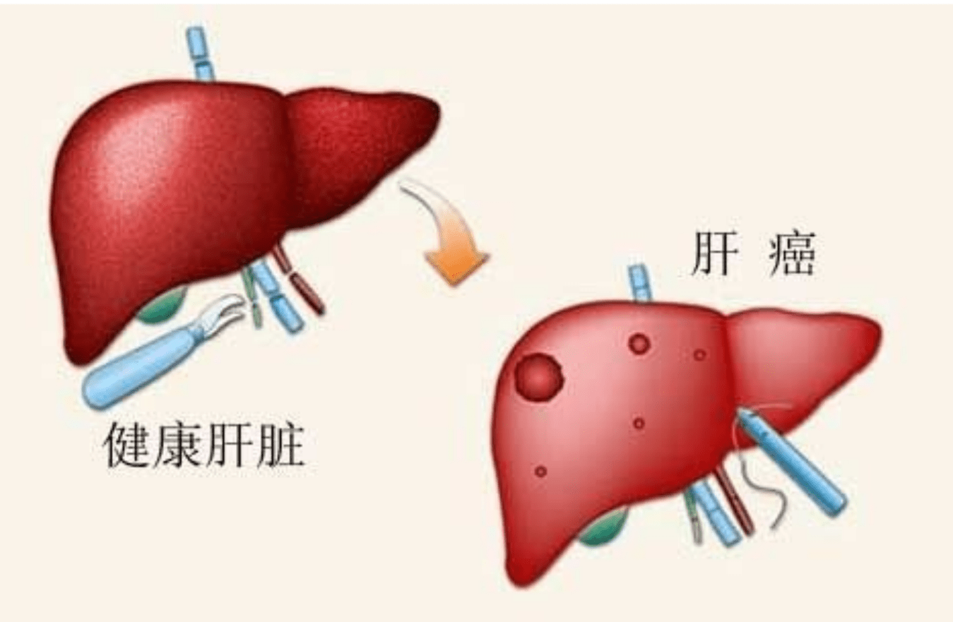 熊金平|电饭煲是肝癌的催化剂？内胆有毒还会致癌？央视实验告诉你答案