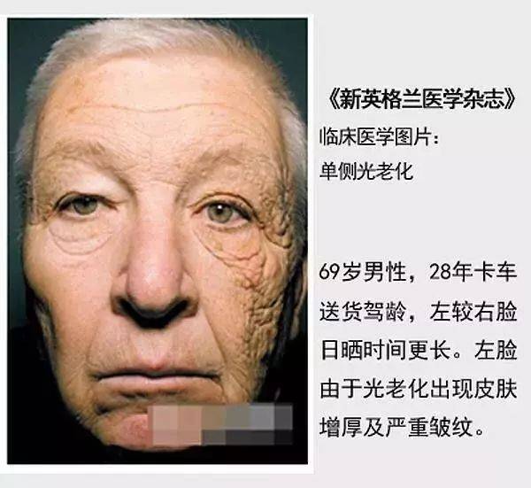 天气春季防晒不做好，夏季黑成宋小宝