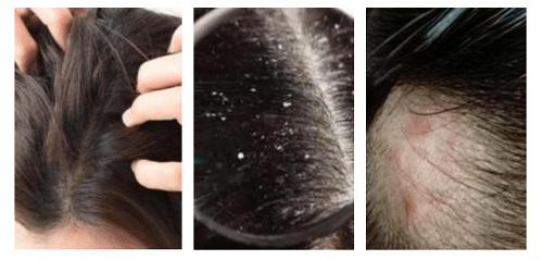 头发舒蕾︱高端线新品牌：SLEK PRO·敏感头皮专研，重磅来袭