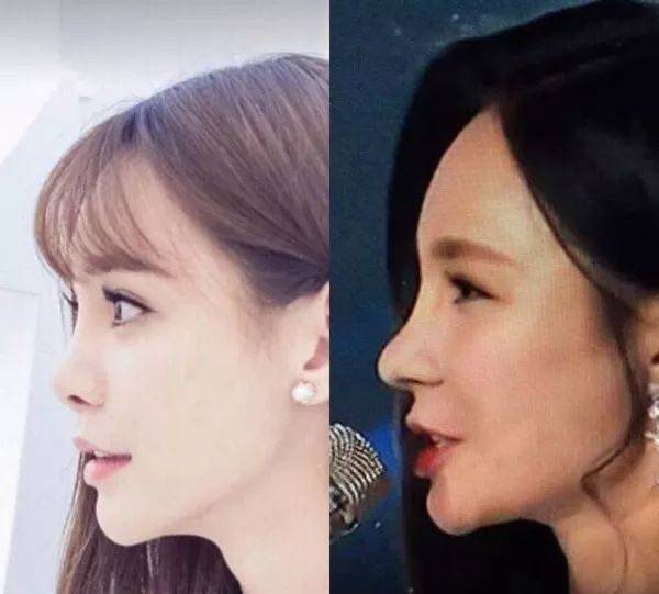下巴整前似大妈、整完变少女？这些“回炉重造”的女明星，太成功了！