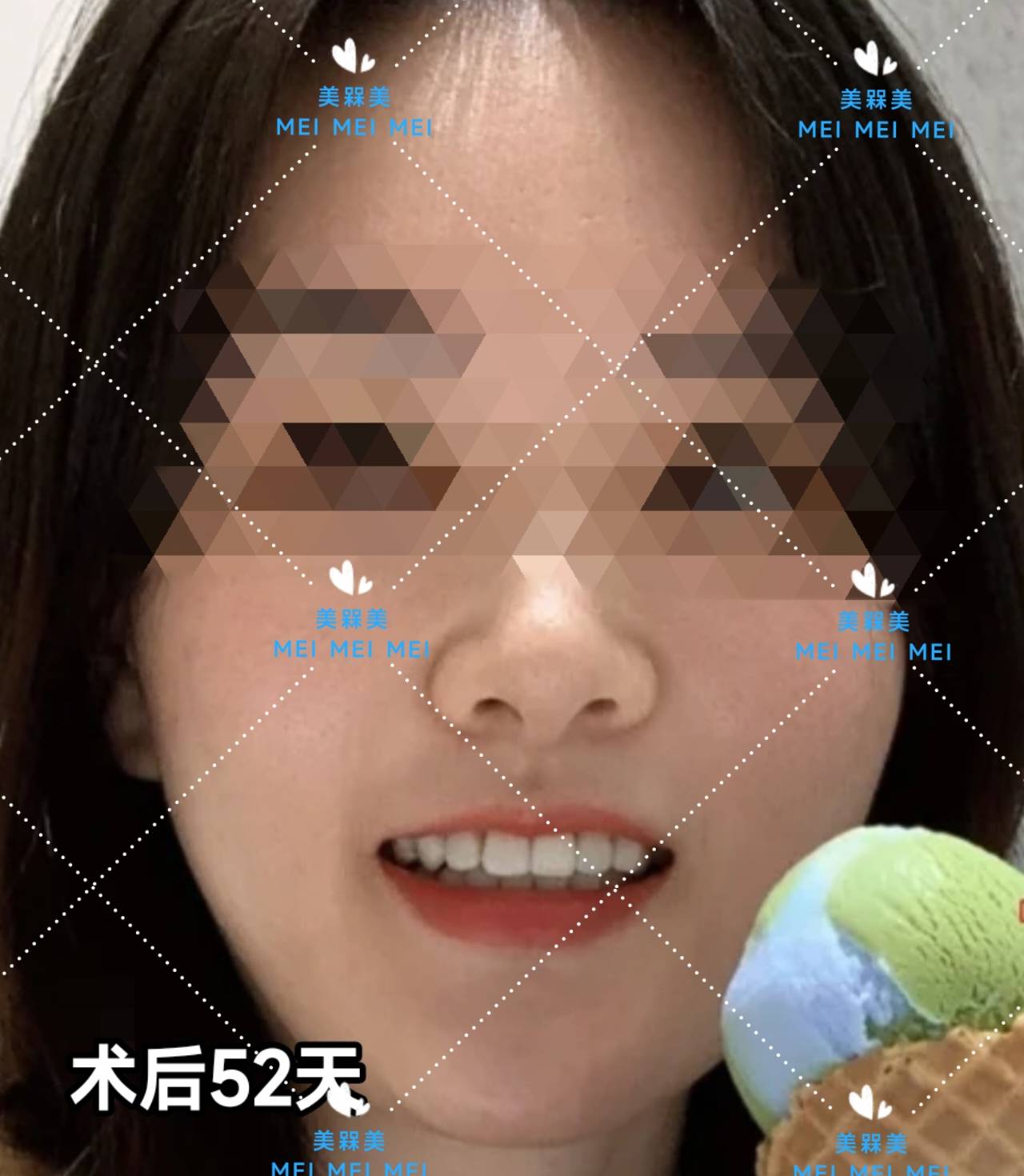 差不多【美人汇】痘痘肌少女的逆袭之路