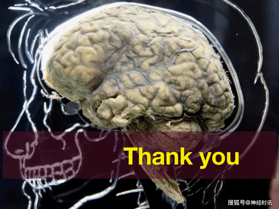 脑皮层的分叶,额叶及顶叶的结构,功能及受损表现【全了】_徐桂_大脑