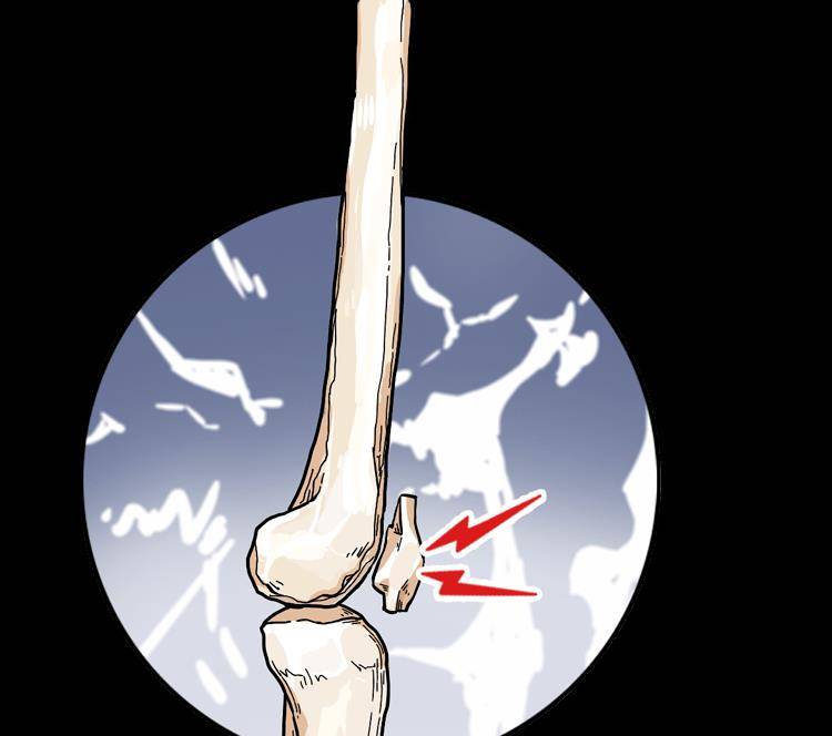 骨骼变形以右腿搭左腿为例跷二郎腿时盆骨自然会向左侧倾斜而脊椎也会