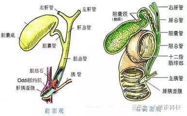 胆管结石怎么治最好图片