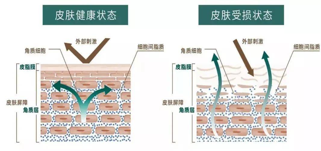 什么皮肤爱敏感女孩必看｜敏感肌护肤知识大合集！