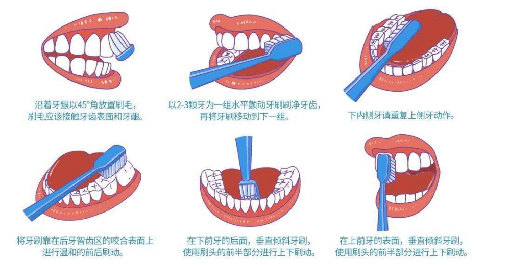 电动牙刷的正确使用方法注意这4点让你的牙齿更健康