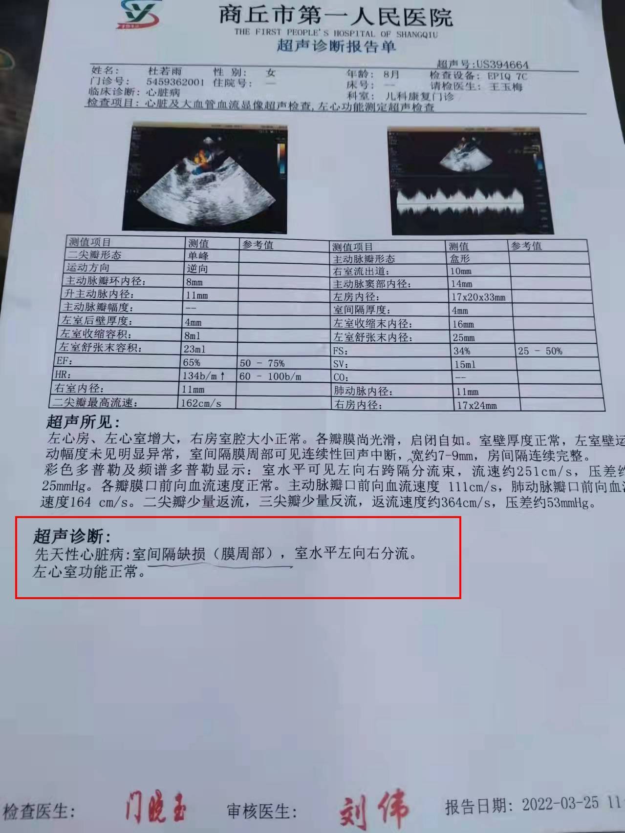 海绵肾超声报告单图片