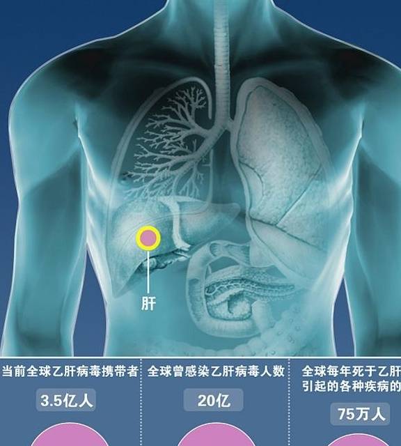 肝功能正常,没有临床表现,也没有肝硬化,患者寿命跟正常人没有明显的