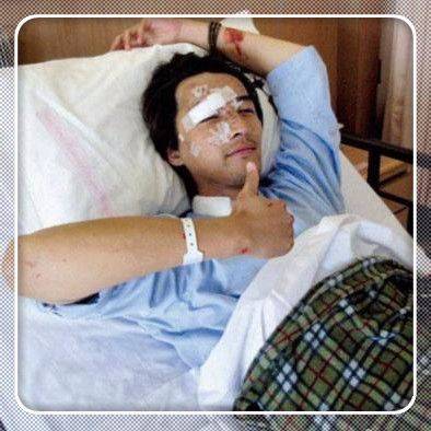 出过车祸的明星胡歌重伤毁容最后一位成为永远的遗憾