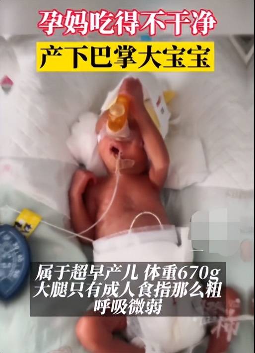 24周孕妇吃不洁食物产下巴掌宝宝，医生：全因这个病菌在作祟