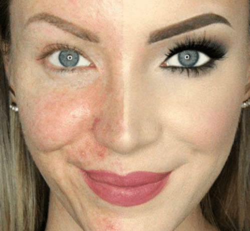 “长期化妆”和“长期素颜”，5年后皮肤有什么区别？看着很明显