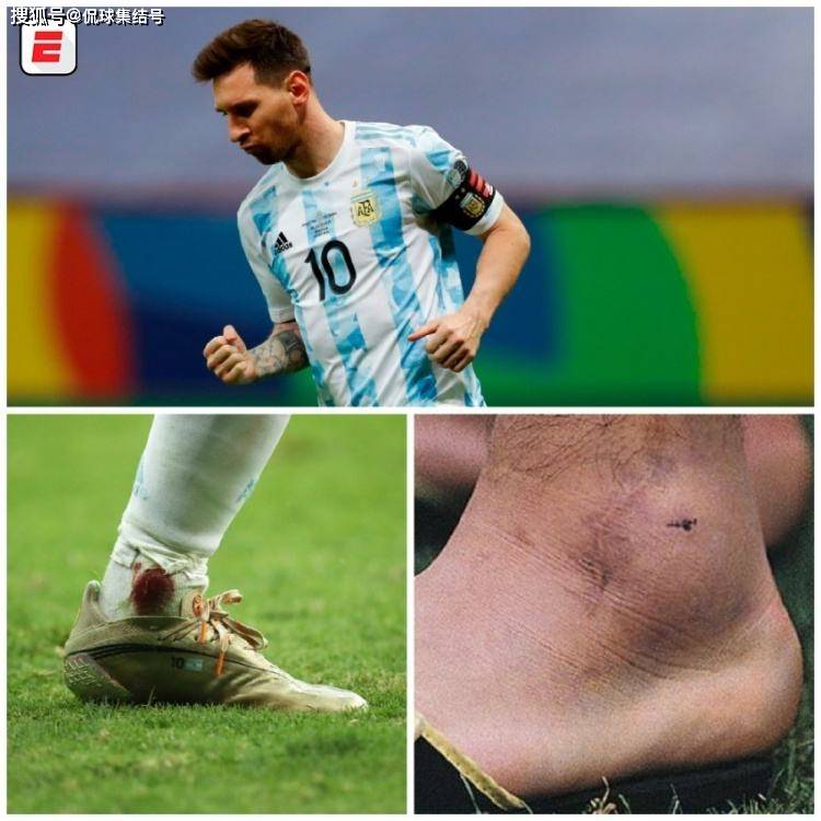 原创腿脚受伤梅西若无其事又暴露缺陷c罗一瘸一拐尽显王者光环