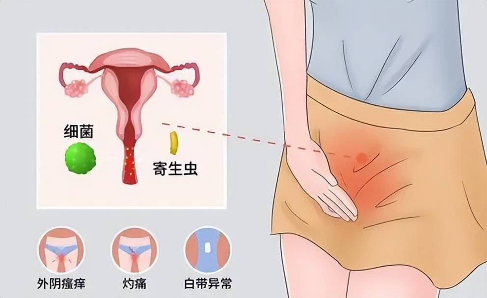【产后阴道炎】产后阴道炎的症状_产后阴道炎怎么治疗