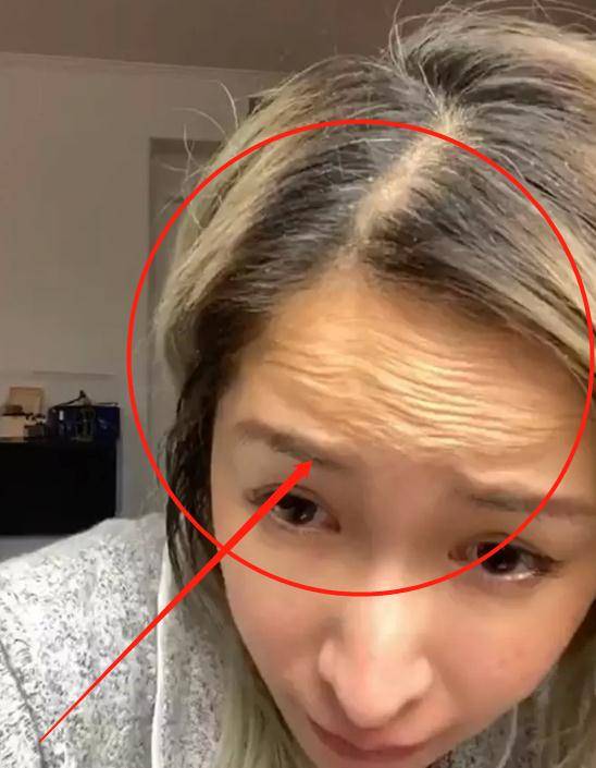 原创萧亚轩卸妆后开视频看到她的抬头纹终于相信她有41岁了