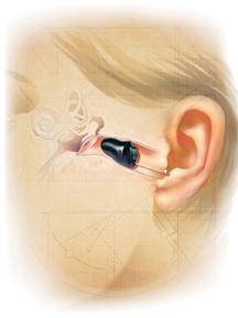 吉安助听器吉安大桥惠耳听力旗舰店深耳道助听器有助于高频听力损失