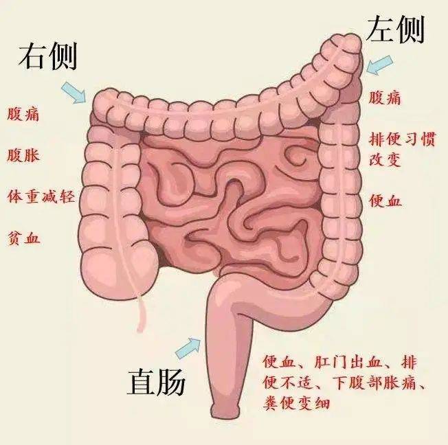 降结肠的位置图片图片