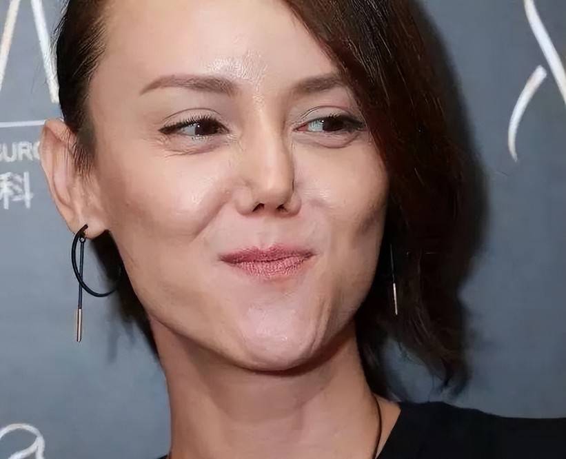 三角鼻孔下巴凹陷20位明星动脸后遗症简直就是整容劝退史