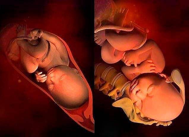 以及产后缝合:但顺产过程中,如果胎儿过大,就需要进行侧切,而分娩过程