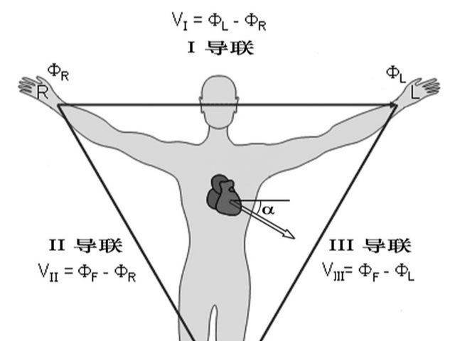肢体导联位置示意图图片