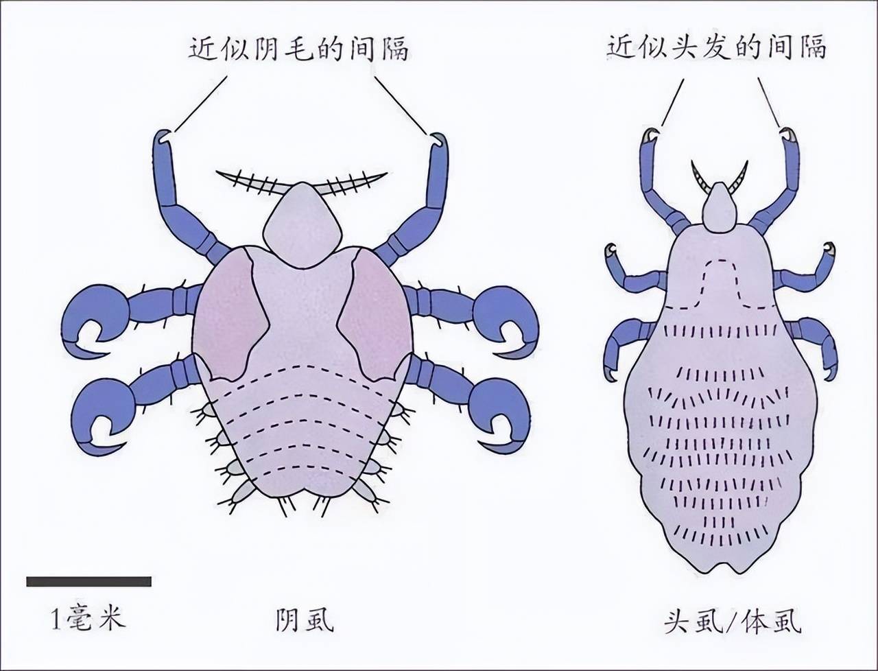 男人阴部长出虱子图片图片