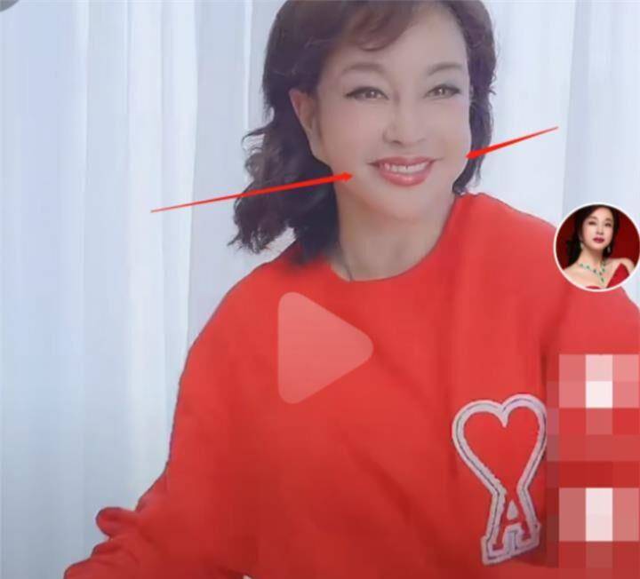 原创65岁刘晓庆近照曝光脸变歪耳垂下巴连一起面具脸好诡异