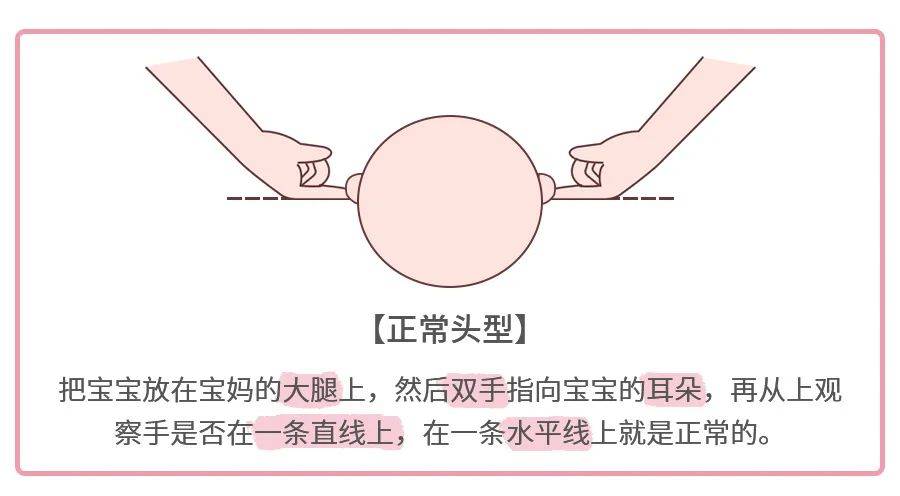 判斷頭型之前,先看看正常圓頭是啥樣的.