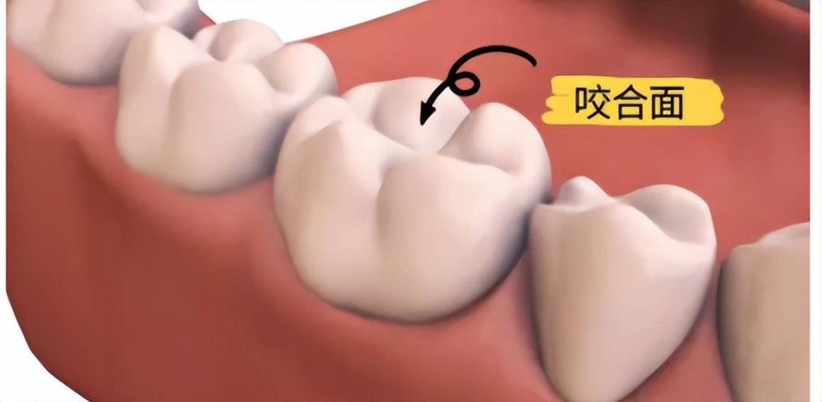两颗牙齿之间的牙缝以及牙齿咬东西那一面(咬合面)