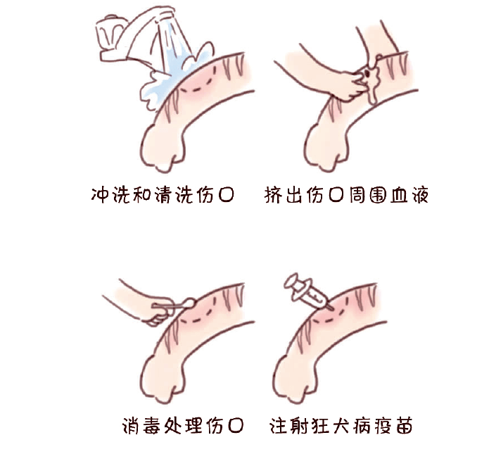 冲洗和清洗伤口→挤出伤口周围血液→消毒处理伤口→注射狂犬病疫苗