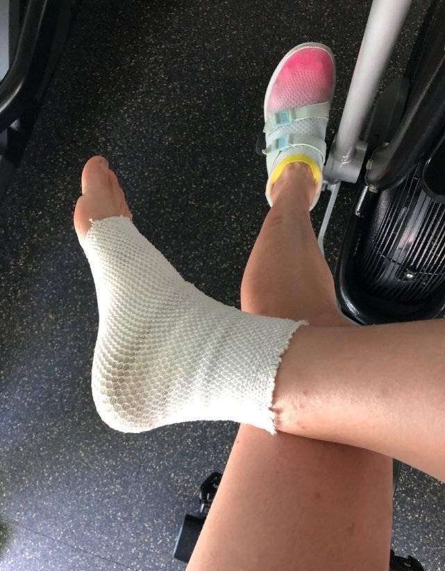 5月20日下午,王婉霏在个人社交平台发文:"昨天老公带去爬山,结果脚扭